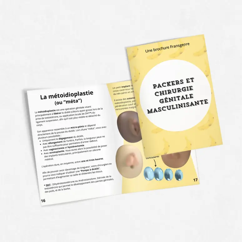 Une brochure &#34;packers et chirurgies génitales masculinisantes&#34; à moitié ouverte.